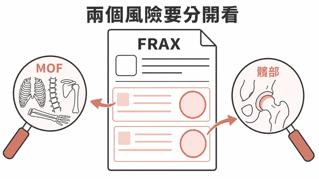 FRAX 的主要骨質疏鬆性骨折與髖部骨折風險示意圖