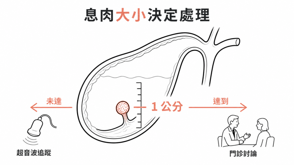 膽囊息肉一公分分界與處理方式