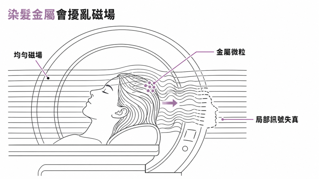示意圖:頭髮上的金屬微粒擾亂磁振造影的均勻磁場,造成局部訊號失真