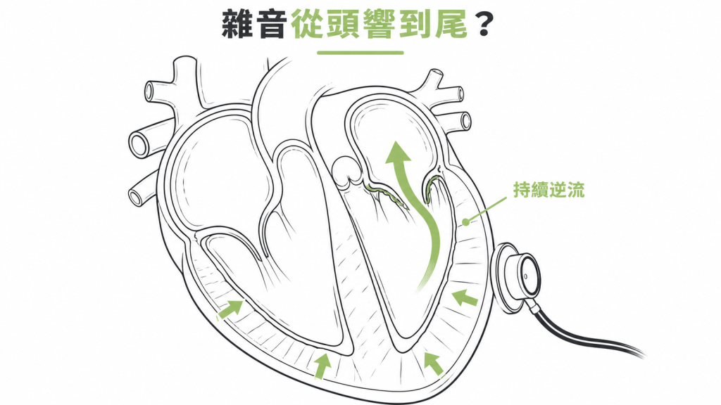全收縮期心雜音示意圖:血液持續逆流造成雜音從頭響到尾