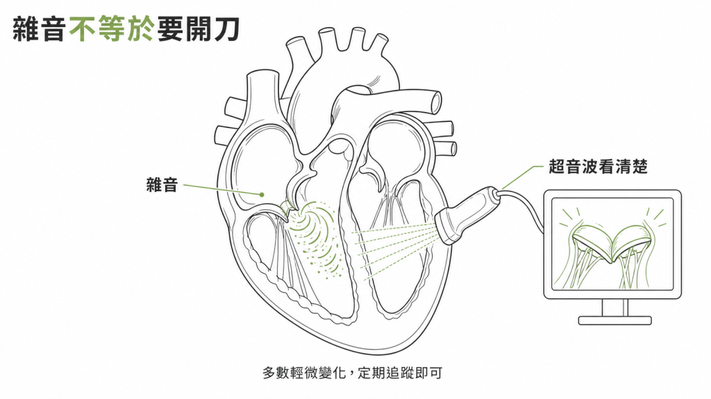 心臟超音波把雜音背後的結構看清楚,多數是輕微變化、定期追蹤即可