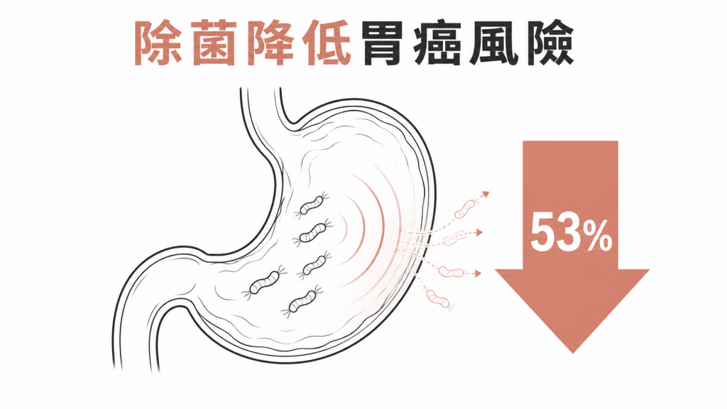 根除幽門螺旋桿菌可降低胃癌發生風險百分之五十三