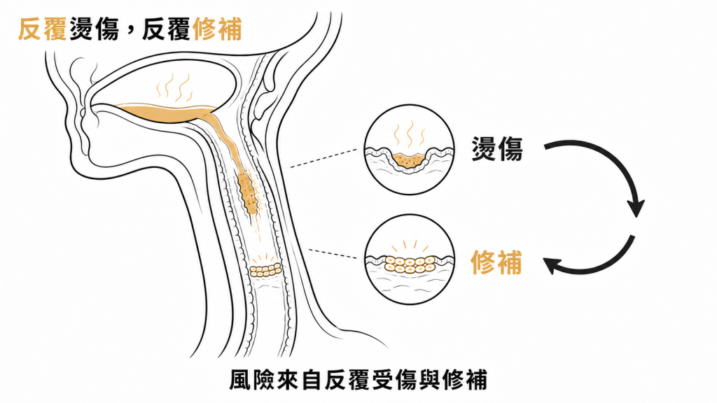 食道黏膜被熱飲反覆燙傷與修補的循環示意圖