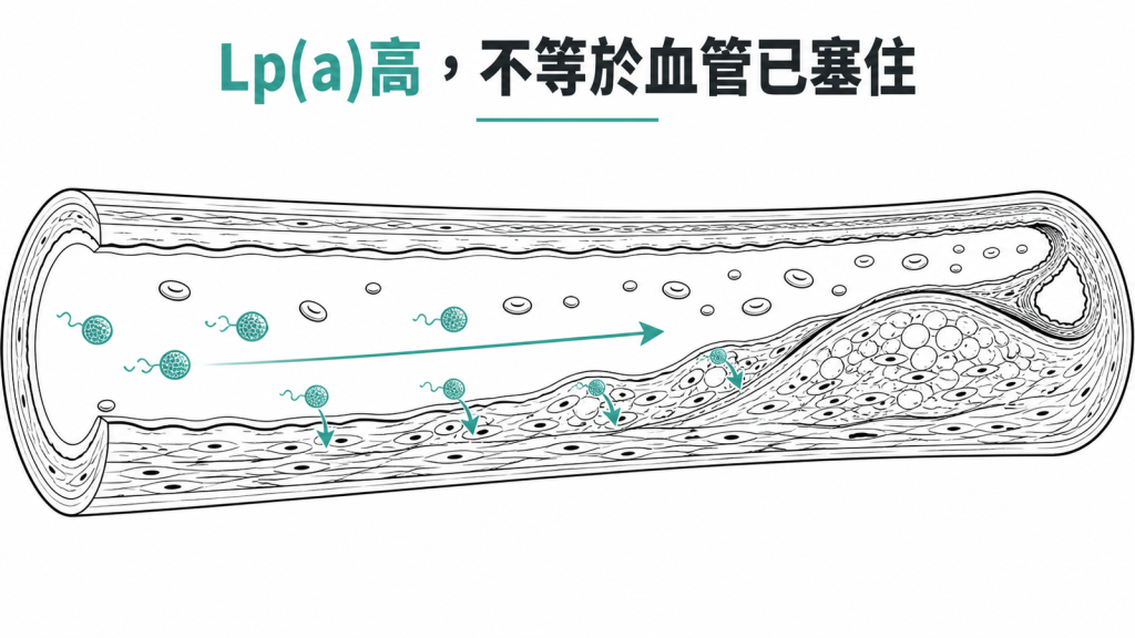 Lp(a) 偏高要經年累積才會讓血管內壁堆出斑塊、逐漸變窄,不等於血管已經塞住