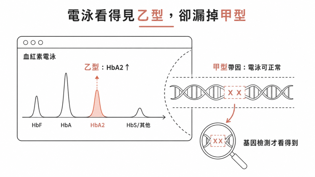 血紅素電泳可看出乙型地中海貧血的 HbA2 升高,卻無法辨識甲型帶因的示意圖