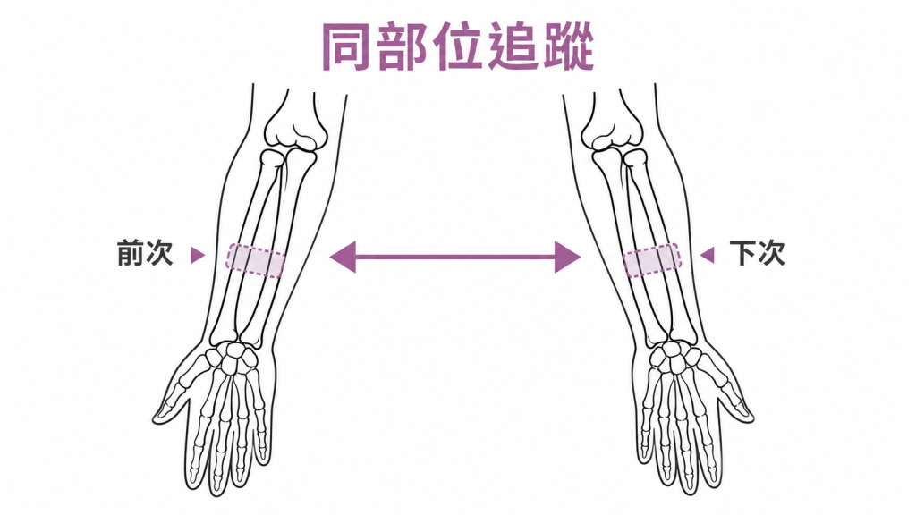 骨密度前後追蹤應測量可比較的同一個合格部位