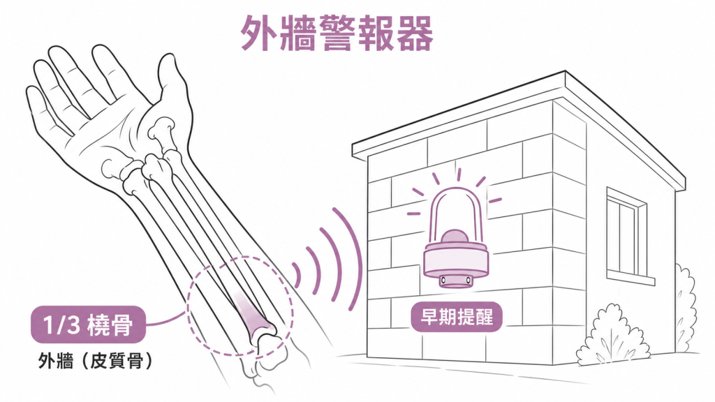 1/3 橈骨以皮質骨為主，像外牆警報器提早提醒骨質流失