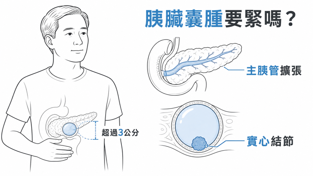 胰臟囊腫要緊嗎？圖解主胰管擴張、囊腫超過 3 公分與實心結節三個關鍵警訊