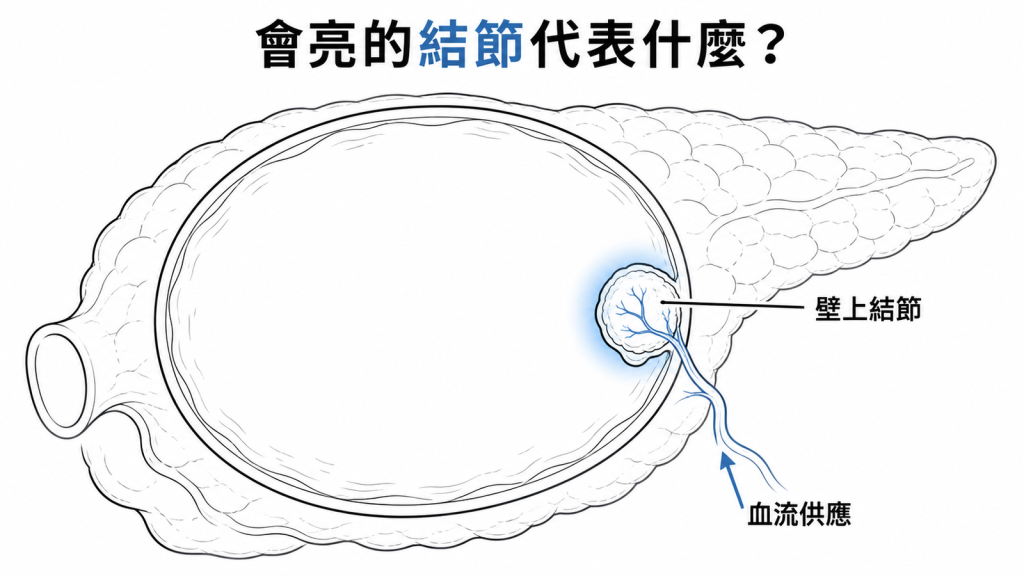 囊腫壁上結節有血流供應，打顯影劑後會亮起來