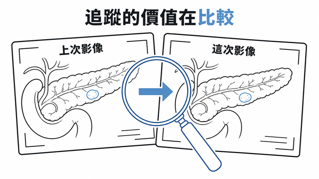 追蹤胰臟囊腫的價值在於比較上次與這次影像的變化