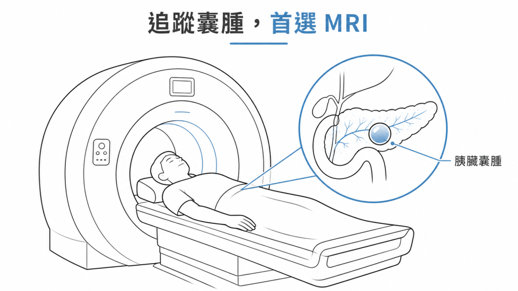 追蹤胰臟囊腫首選 MRI/MRCP，看得清囊腫與胰管的關係