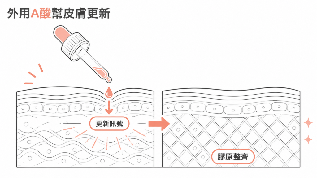 外用A酸傳遞更新訊號並整理膠原纖維示意圖