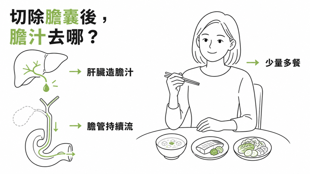 膽囊切除後膽汁從肝臟經膽管持續流入十二指腸的示意圖