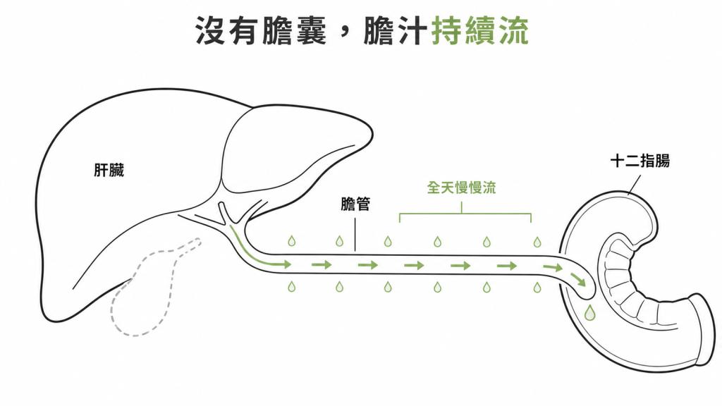 沒有膽囊之後膽汁改為全天持續流動、不再等進食才放行的示意圖