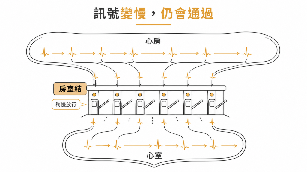 房室結像收費站,電訊號通過時稍微變慢但不會被擋掉的示意圖