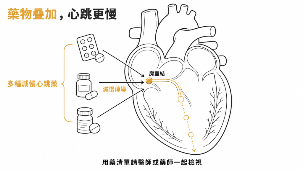 多種減慢心跳的藥物同時作用於房室結、提高心搏過緩風險的示意圖