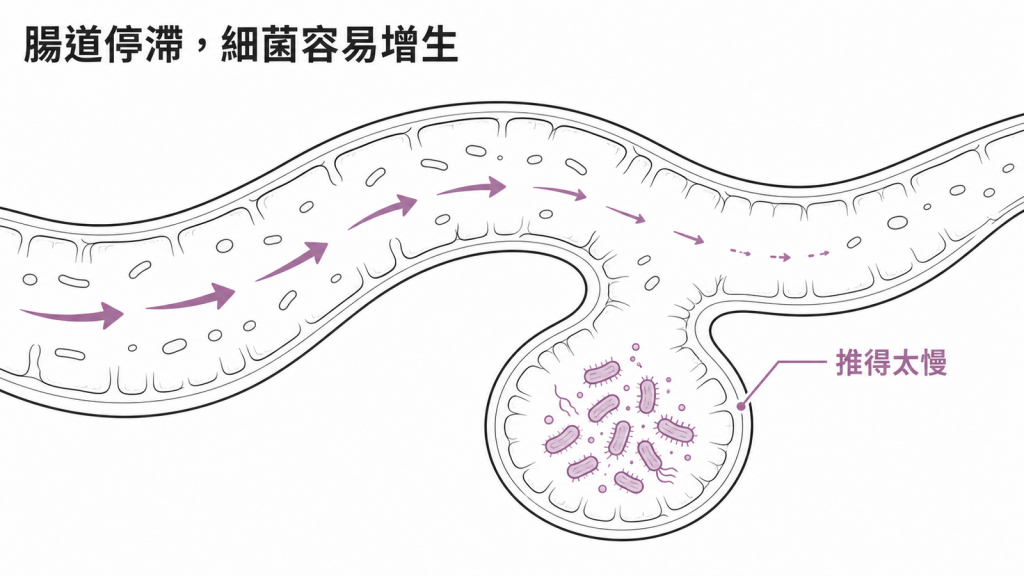 小腸移動太慢形成停滯區，讓細菌容易增生的圖解