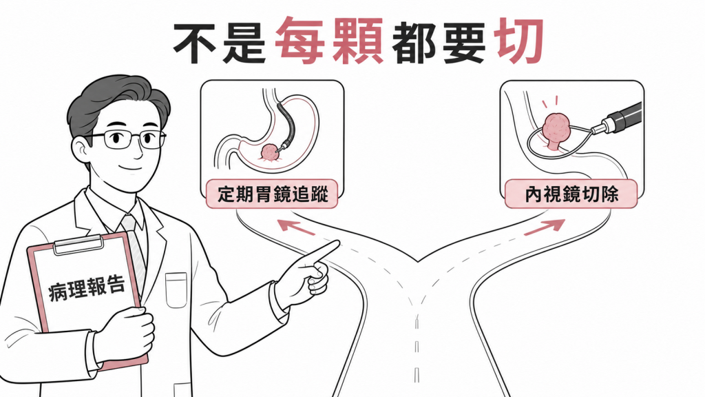 胃息肉依病理類型決定追蹤或切除