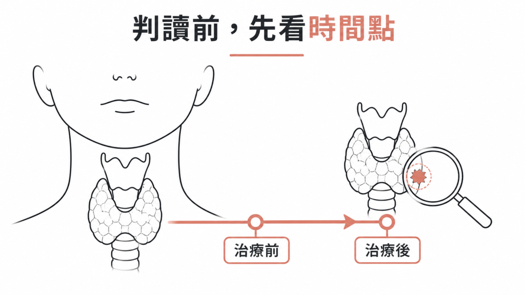 判讀甲狀腺超音波前先確認是治療前還是治療後的影像