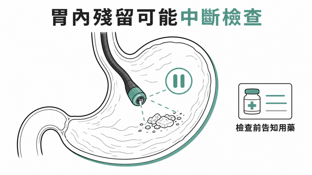 胃內食物殘留可能讓內視鏡檢查中斷