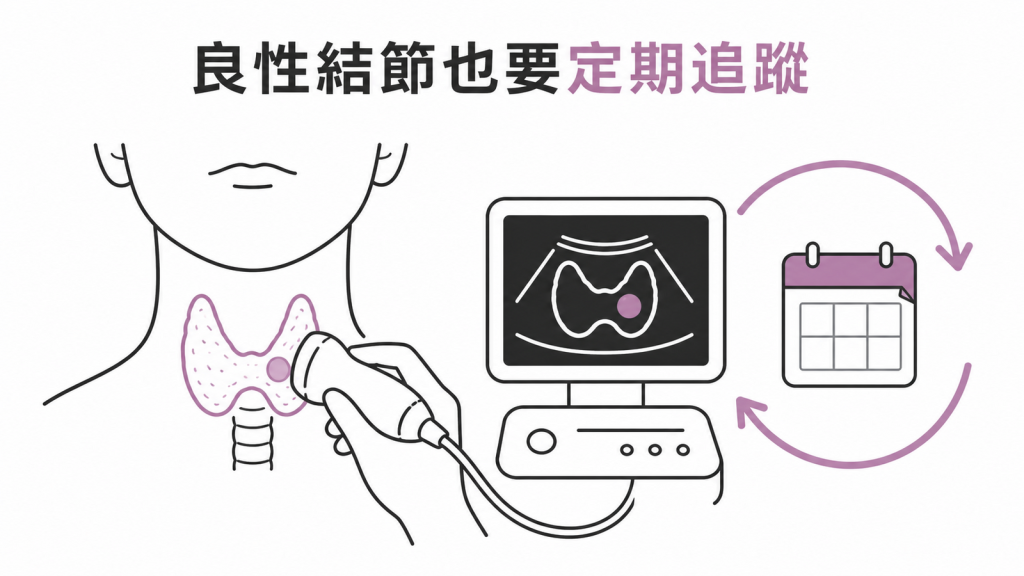 良性甲狀腺結節也需要規律超音波追蹤