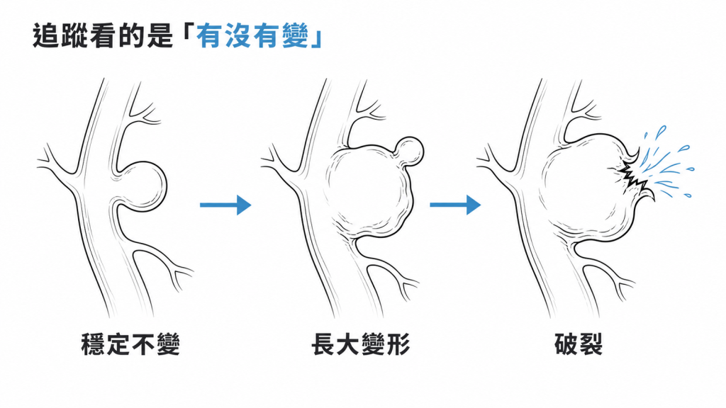 動脈瘤追蹤三階段：穩定不變、長大變形、破裂的箭頭流程示意圖