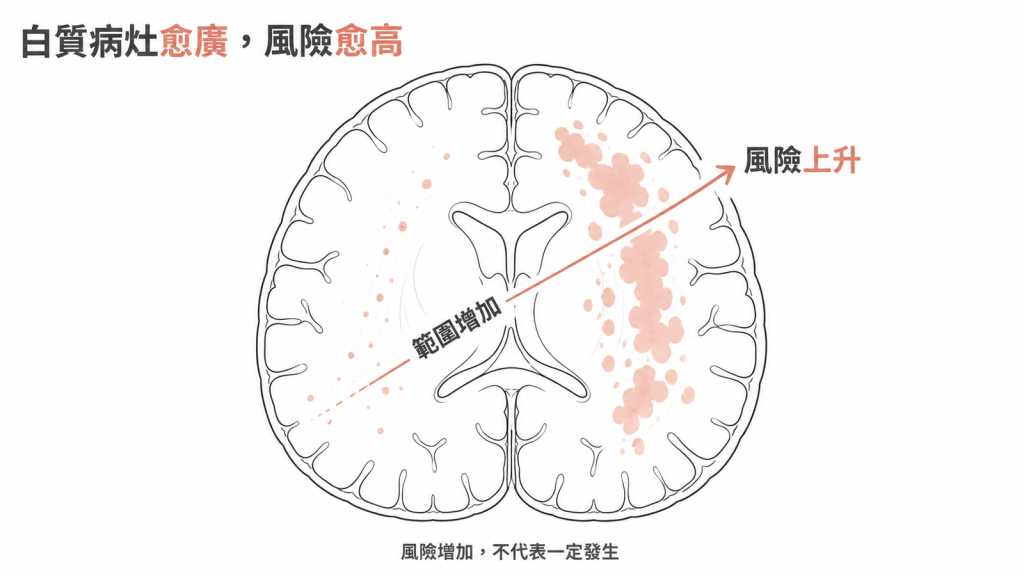 白質病灶範圍愈廣,中風與失智風險愈高,但風險增加不代表一定發生