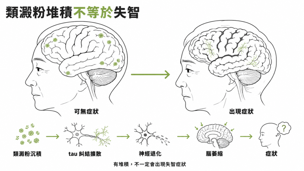 從類澱粉沉積、tau 糾結擴散、神經退化到腦萎縮才出現症狀,說明腦中有堆積不等於已經失智