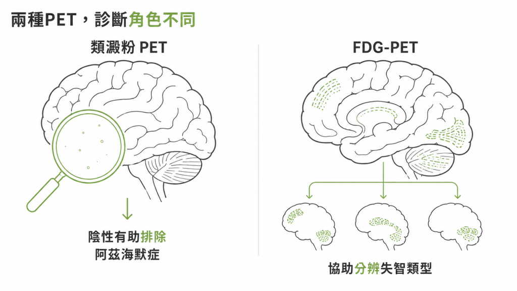 類澱粉 PET 與 FDG-PET 角色比較:前者陰性有助排除阿茲海默症,後者協助分辨失智類型