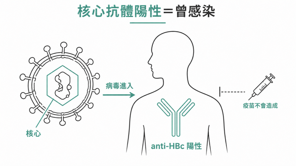 anti-HBc 是核心抗體,只有病毒真的進過身體才會轉陽,B 肝疫苗不會讓這一格陽性