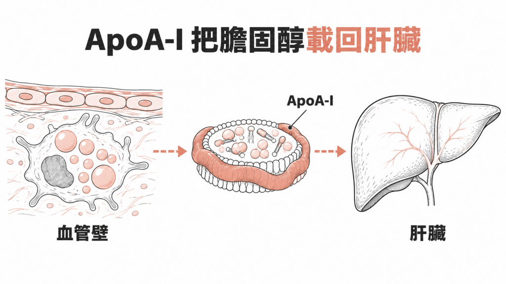 血管壁裡的巨噬細胞含有膽固醇滴,膽固醇交給外圈由 ApoA-I 構成的碟狀 HDL 顆粒,再送回肝臟處理
