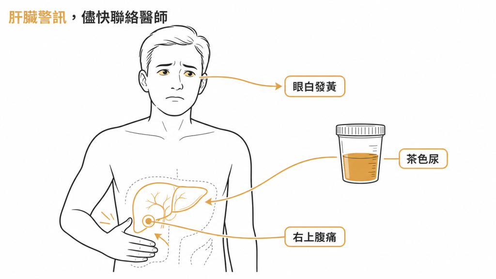 服藥期間出現眼白發黃、茶色尿、右上腹痛,是要儘快聯絡醫師的肝臟警訊