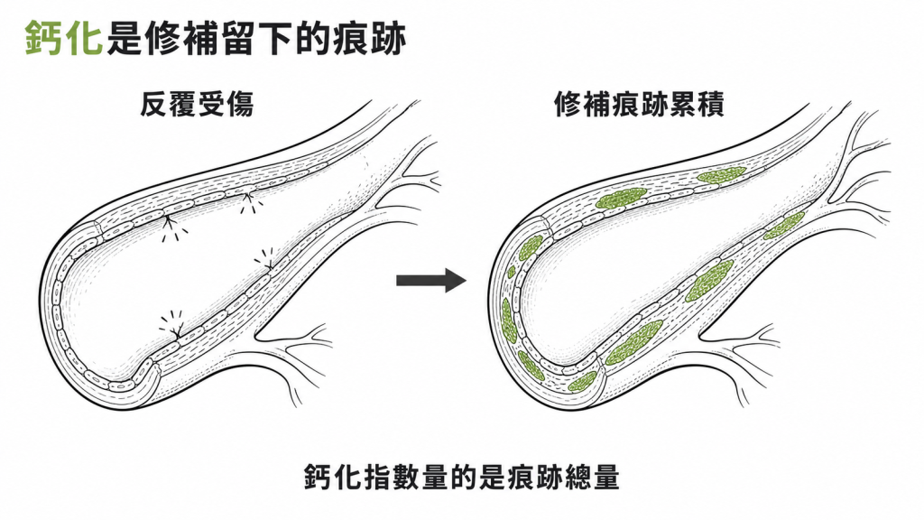 鈣化是血管反覆受傷後、身體修補留下的痕跡,鈣化指數量的是這些痕跡累積的總量
