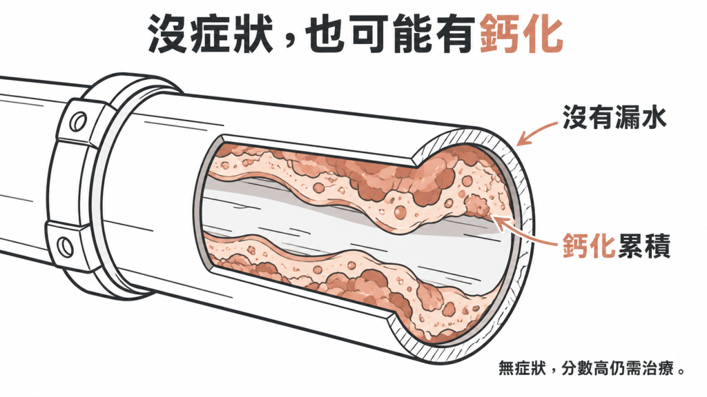 沒有症狀也可能已有冠狀動脈鈣化累積,鈣化分數高仍需治療