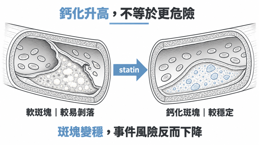 吃 statin 後斑塊變穩定,鈣化分數可能升高,但心血管事件風險下降