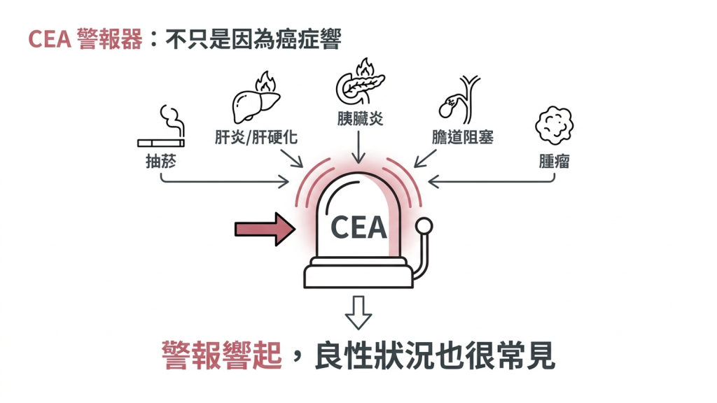 一台正在響的警報器，周圍連著香菸、肝臟、胰臟與膽道的圖示，並標示腫瘤只是其中一種可能原因