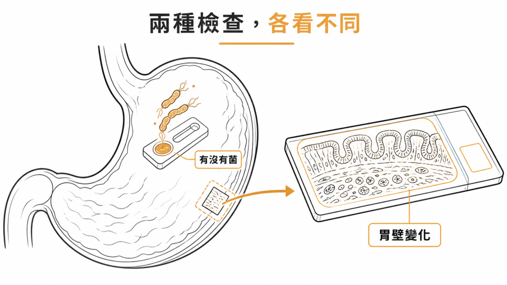 CLO test 看有沒有幽門桿菌、病理切片看胃壁變化的分工對照示意圖