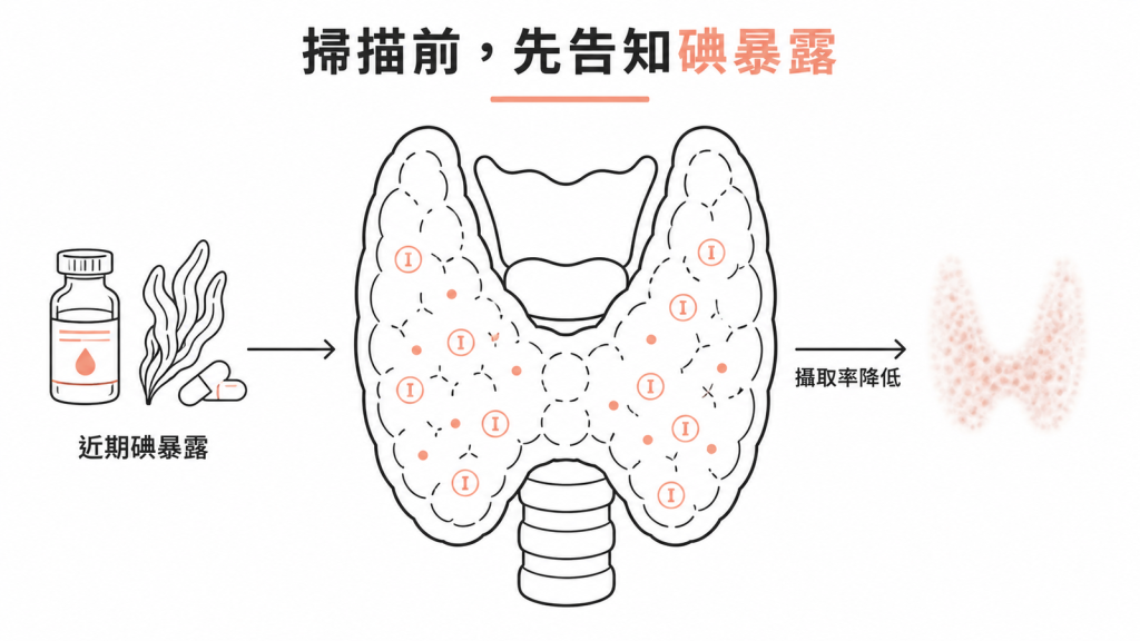 近期顯影劑或含碘食物與保健品會壓低甲狀腺攝取率，安排掃描前要主動告知醫師