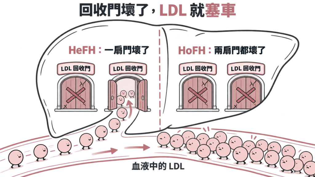 比喻一:一間店有兩扇門:肝臟像一間店,壞膽固醇是客人,LDL 受體是讓客人進店的「回收門」。異型合子 HeFH 是其中一扇門