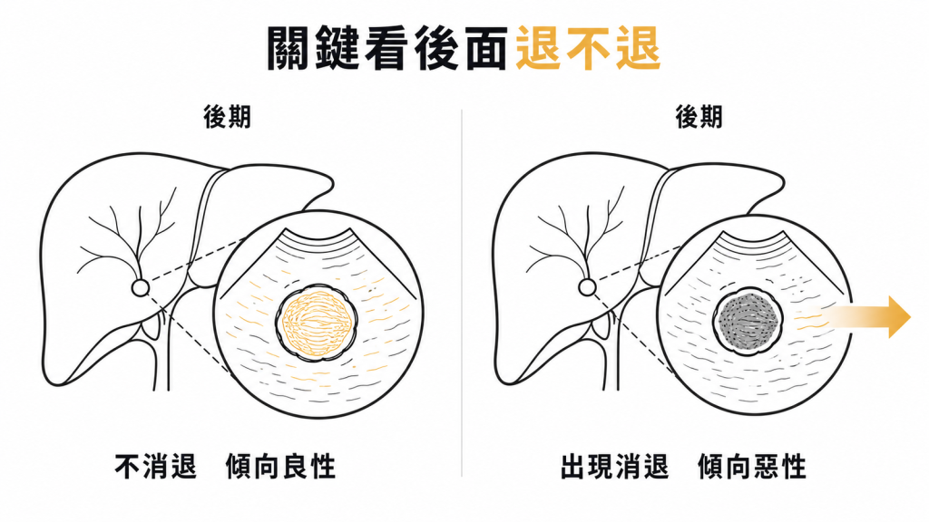 顯影劑後期的左右對照：不消退傾向良性，出現消退傾向惡性