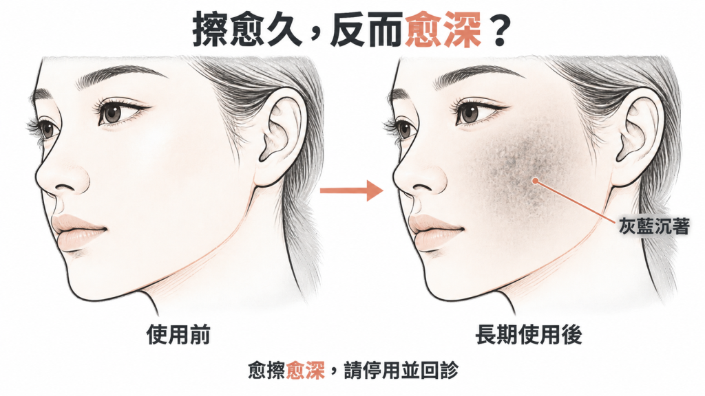 外源性褐黃症：長期使用對苯二酚後，治療部位反而浮現灰藍色調沉著