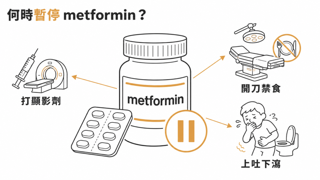 metformin 需要依醫囑暫時停藥的情況:打顯影劑、開刀禁食、上吐下瀉
