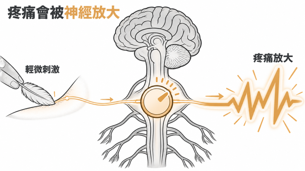 痛持續變強時神經會變得過度敏感，輕微刺激也被放大成很痛，這叫中樞敏感化
