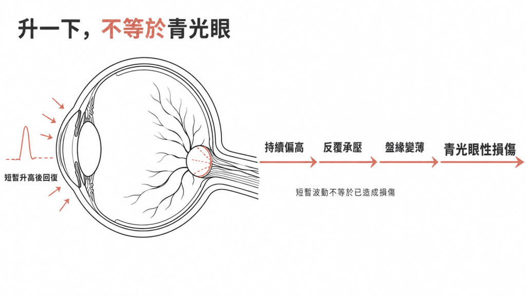 眼壓短暫升高後回復,與青光眼性損傷之間還要經過持續偏高、反覆承壓、盤緣變薄的流程示意圖