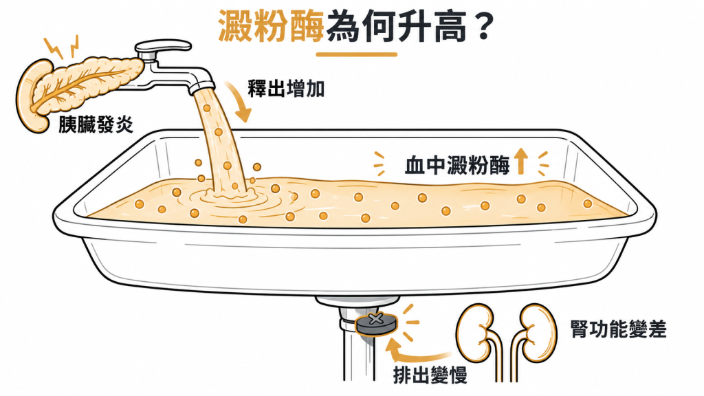洗手台示意圖：水龍頭代表胰臟發炎時釋出澱粉酶，塞住的排水孔代表腎功能變差、澱粉酶排不出去