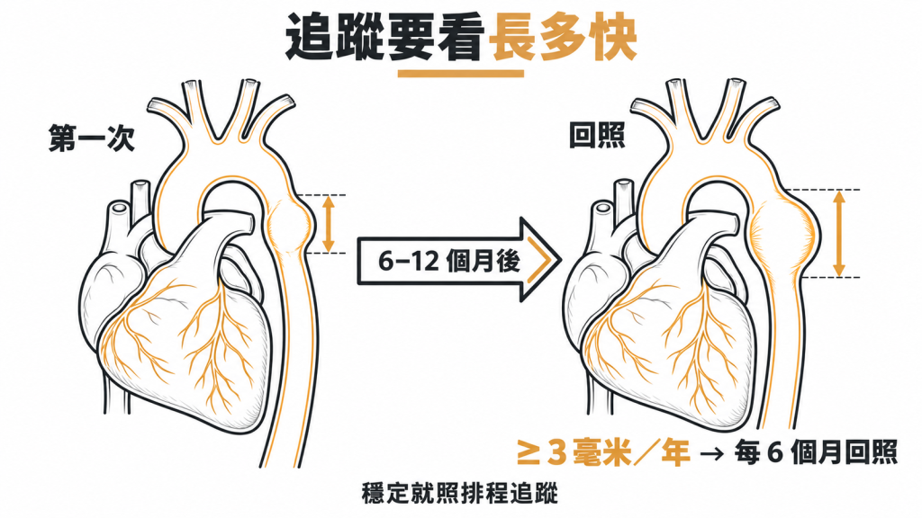 胸主動脈瘤追蹤看成長速度:6 到 12 個月回照,一年長大 3 毫米以上改每 6 個月回照