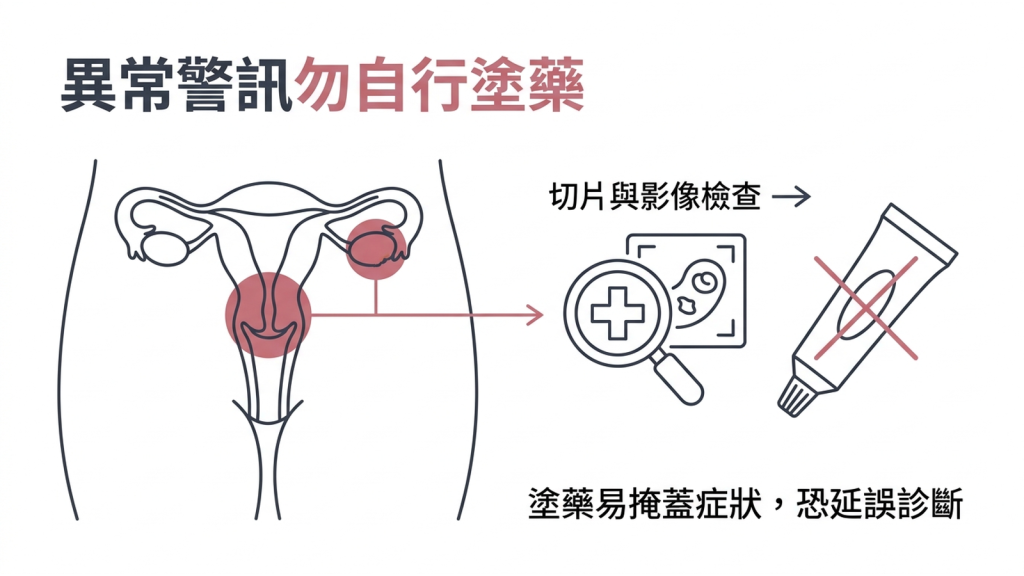 警示資訊圖列出出血、子宮頸腫塊、發燒合併觸痛、卵巢附近腫塊四項警訊，旁邊註明要做切片或影像，不宜先自行用藥